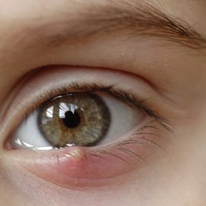 Ma Paire de lunettes - Santé visuelle - Orgelet Oculaire